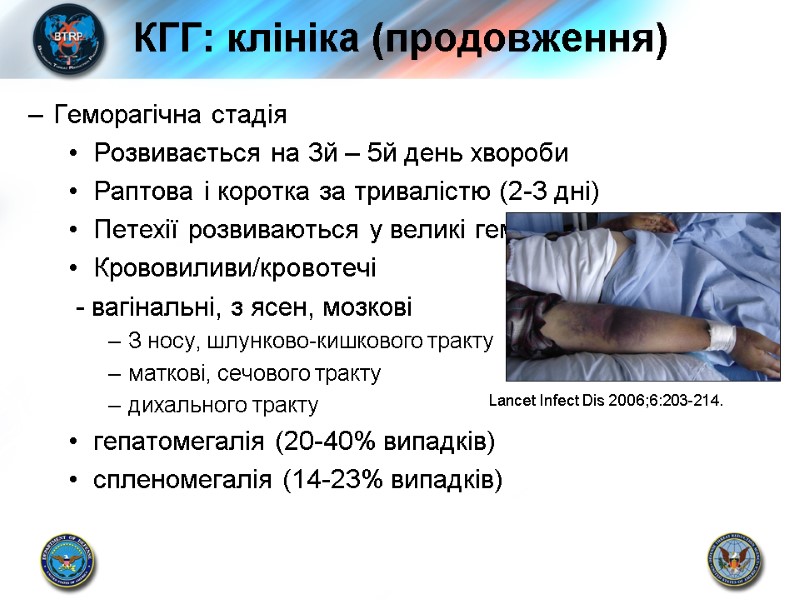 КГГ: клініка (продовження) Геморагічна стадія Розвивається на 3й – 5й день хвороби Раптова і
